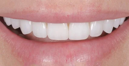 After Image