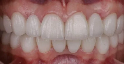 After Image